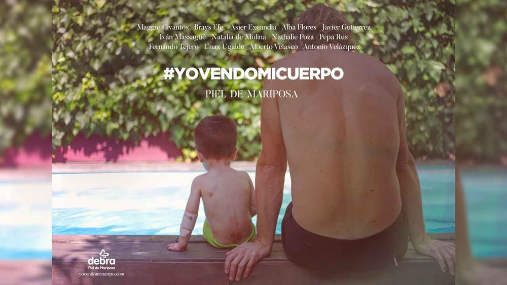 #YoVendoMiCuerpo, la campaña para concienciar sobre la enfermedad Piel de Mariposa (Incl. Spot)