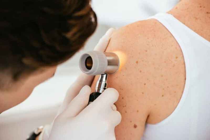 Dermatologia Cancer de Piel